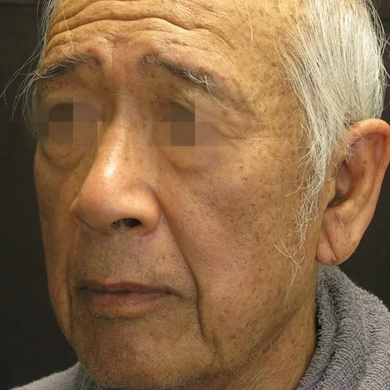 Pessoa idosa de cabelo grisalho e rugas faciais, vestindo uma camisola.