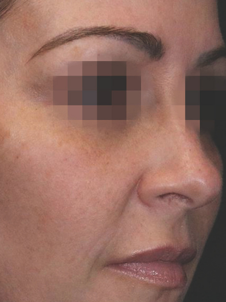Grande plano do rosto de uma mulher com os olhos pixelizados, mostrando maquilhagem e sobrancelhas definidas.