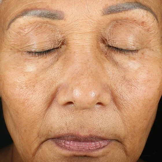 Grande plano do rosto de uma pessoa idosa de olhos fechados, mostrando a textura da pele e rugas naturais.