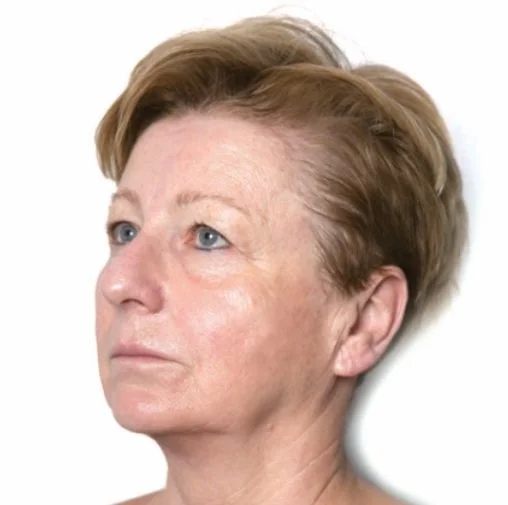 Perfil de uma mulher de meia-idade de cabelo curto a olhar para cima