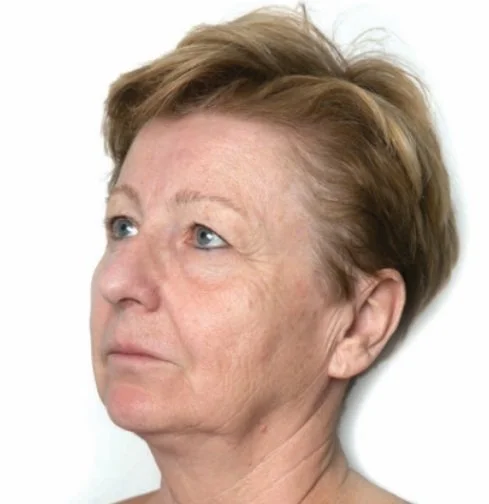 Mulher mais velha de cabelo curto a olhar para o lado, sobre fundo branco.