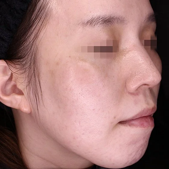 Grande plano do rosto de uma mulher com os olhos pixelizados e pele limpa.