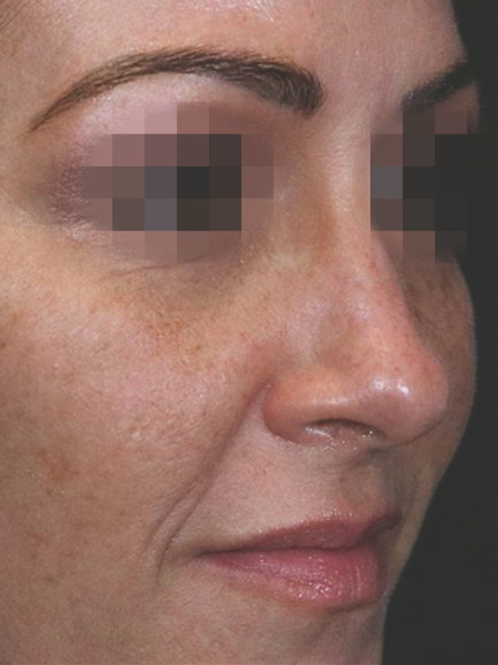 Grande plano do rosto de uma mulher com os olhos pixelizados, mostrando a textura da pele e maquilhagem nas sobrancelhas e nos lábios.